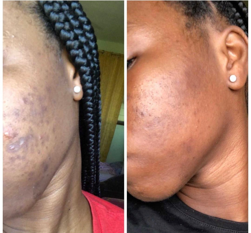 40k Pigmentation Bundle