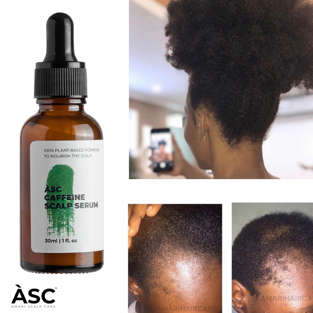 Amari Caffeine Scalp Serum
