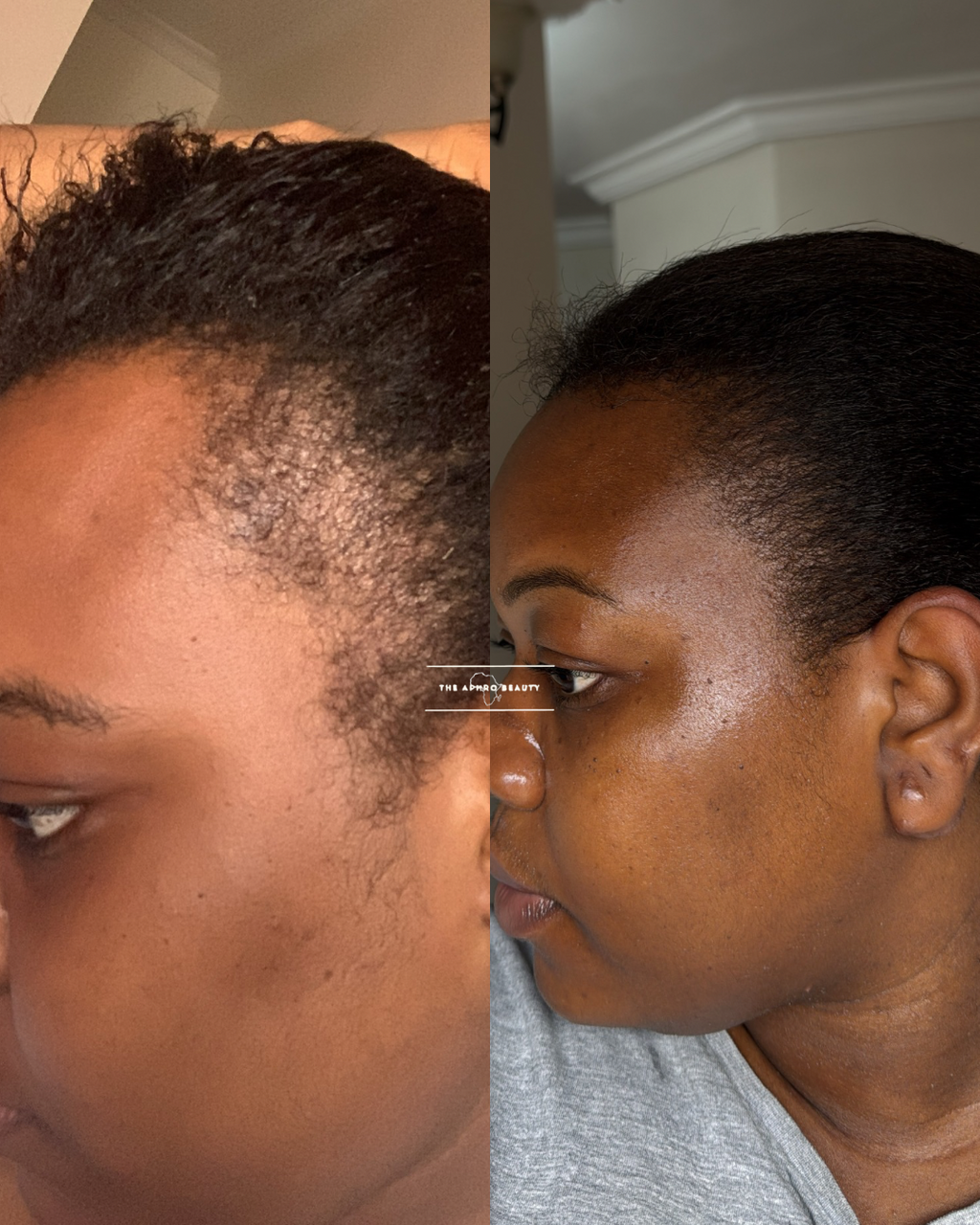 Amari Caffeine Scalp Serum