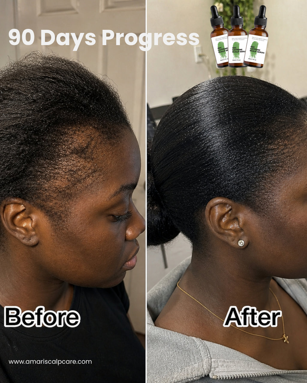 Amari Caffeine Scalp Serum