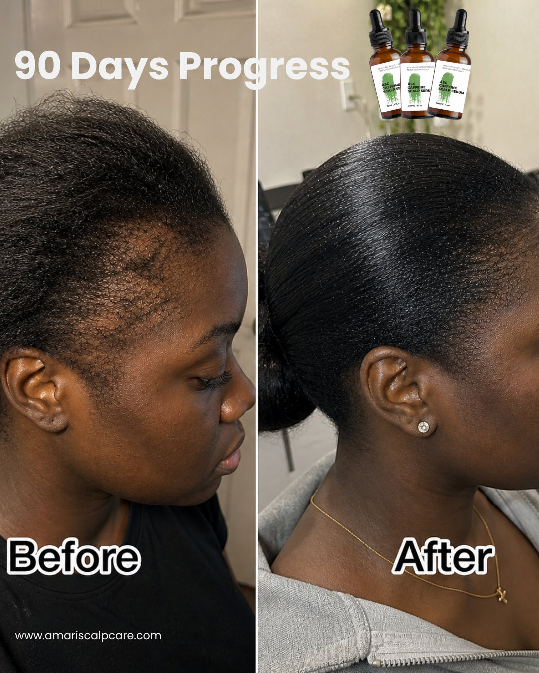 Amari Caffeine Scalp Serum