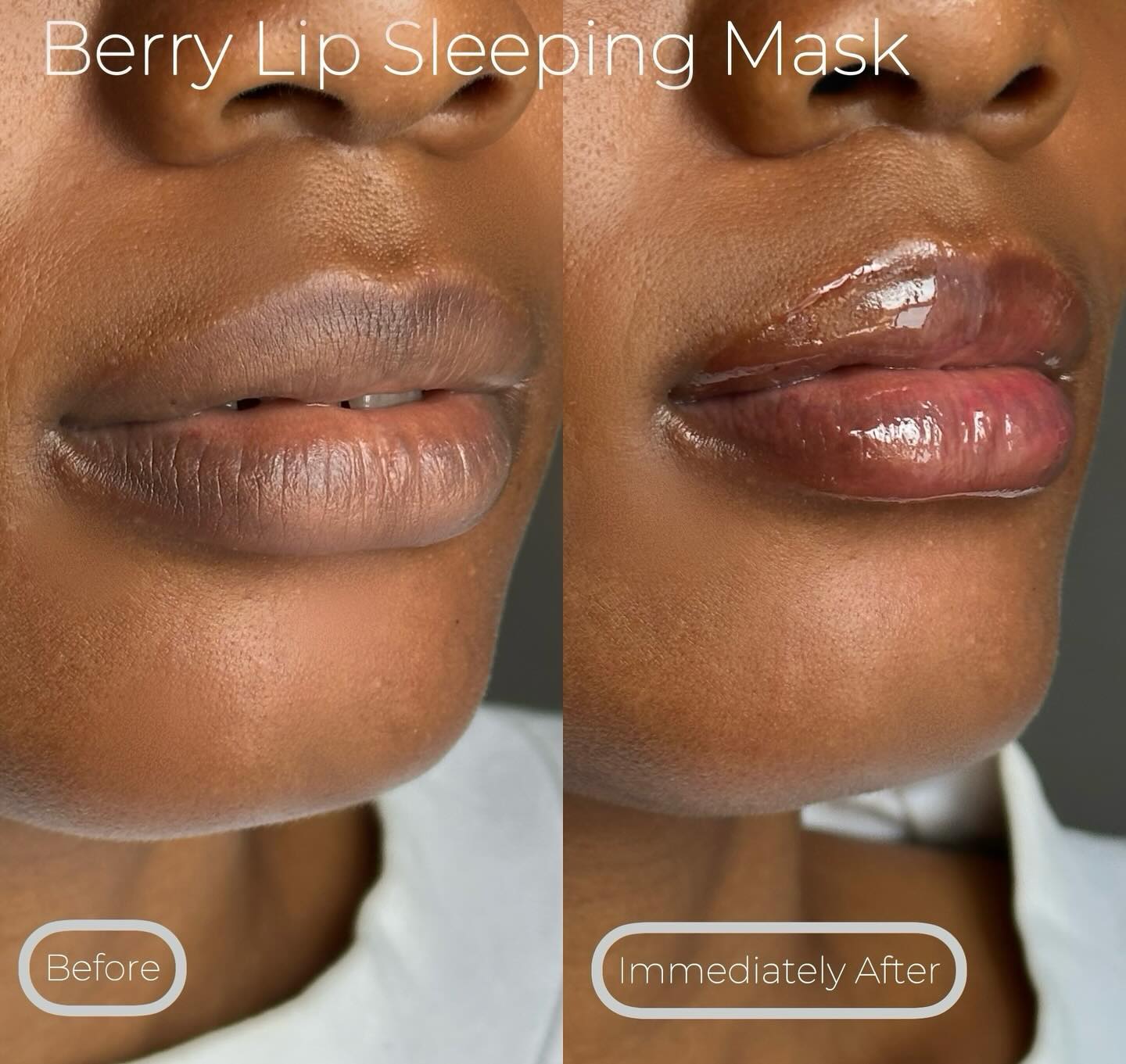 Skin by Tej Berry Lip Mask