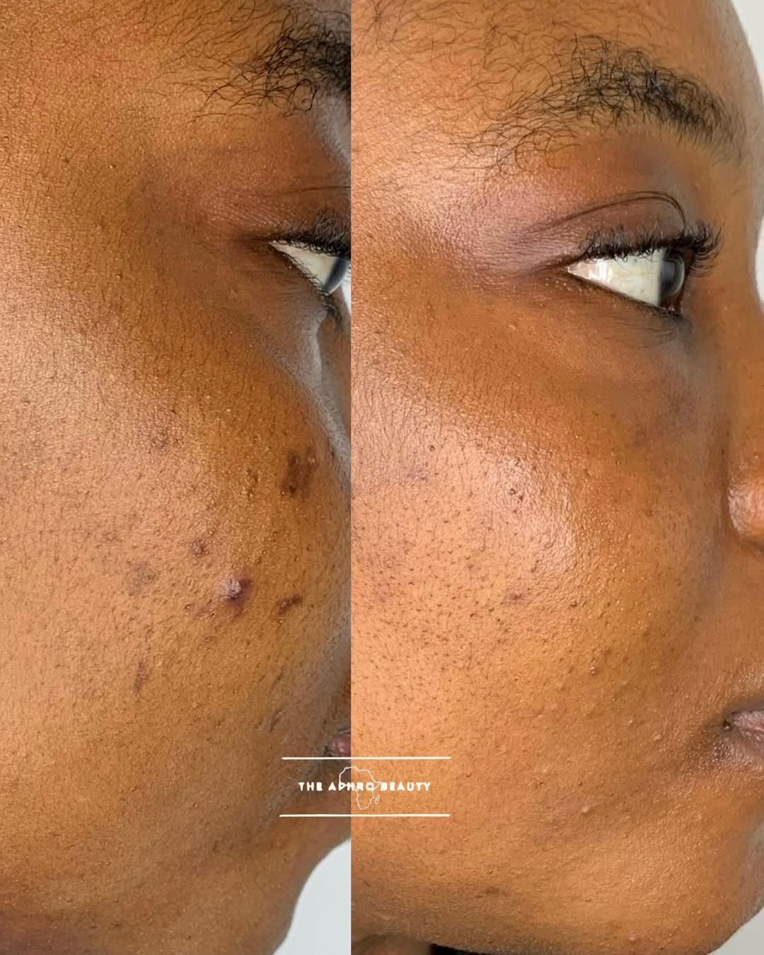40k Pigmentation Bundle